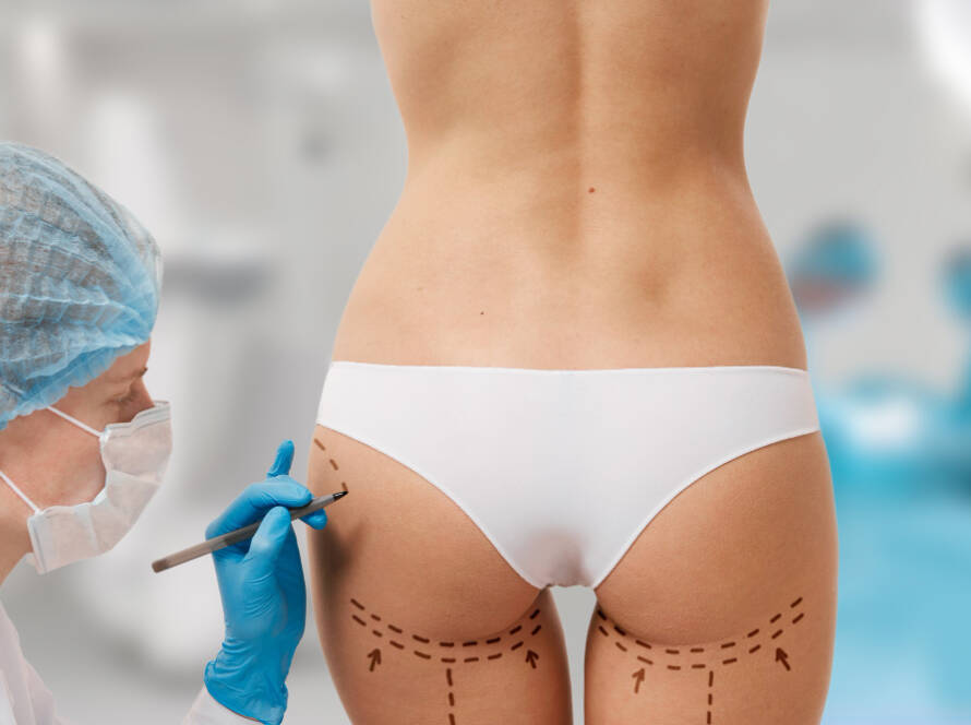 Non-Surgical Butt Lift Treatment