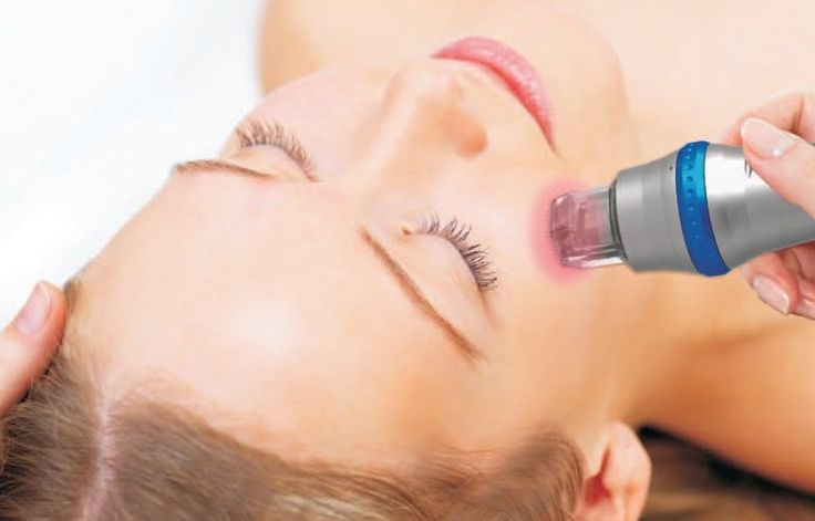 Micro-needling radio Frequency Treatment