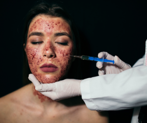 women going through Vampire Facial