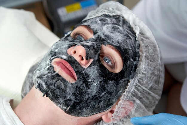 women going through Vampire Facial