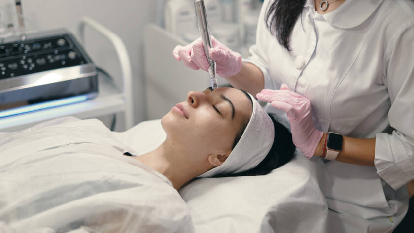 Microneedling treatment