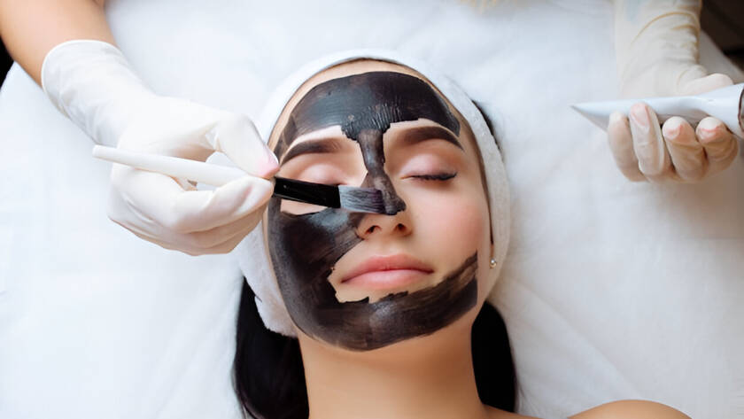 Carbon Facial Treatment