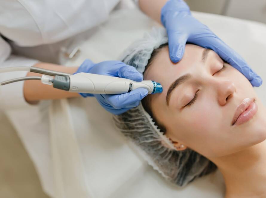 Microneedling