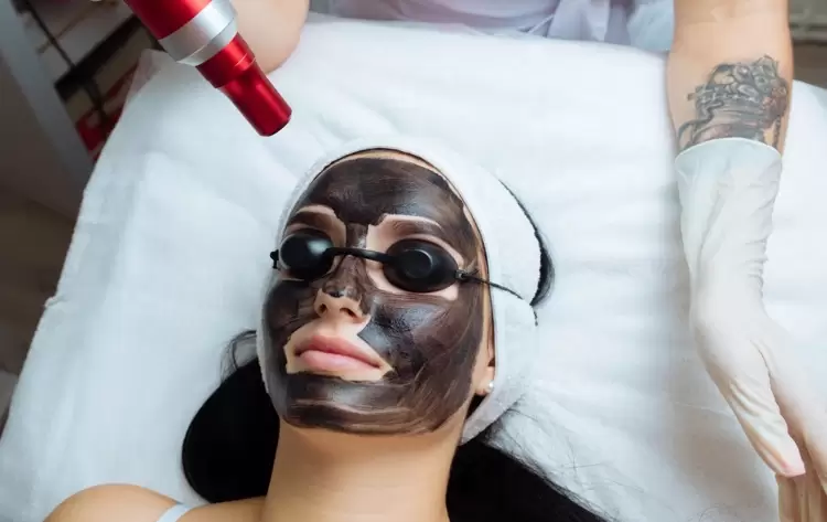 Carbon Facial Treatment