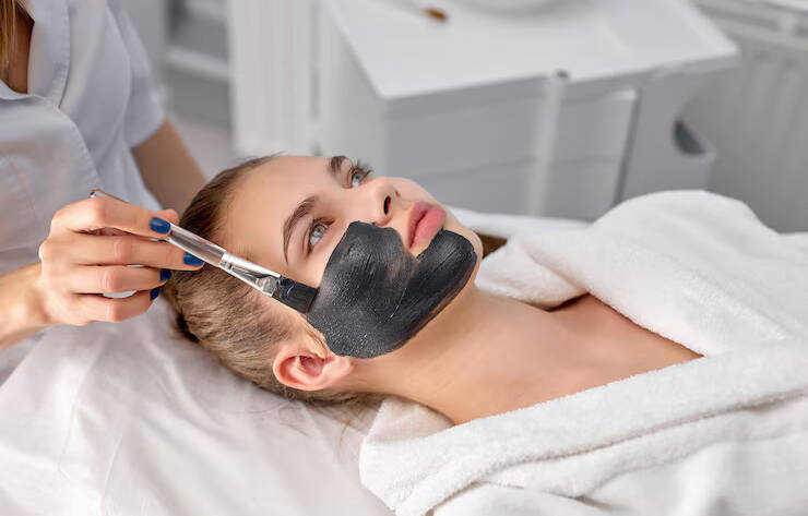 Carbon Facial Treatment