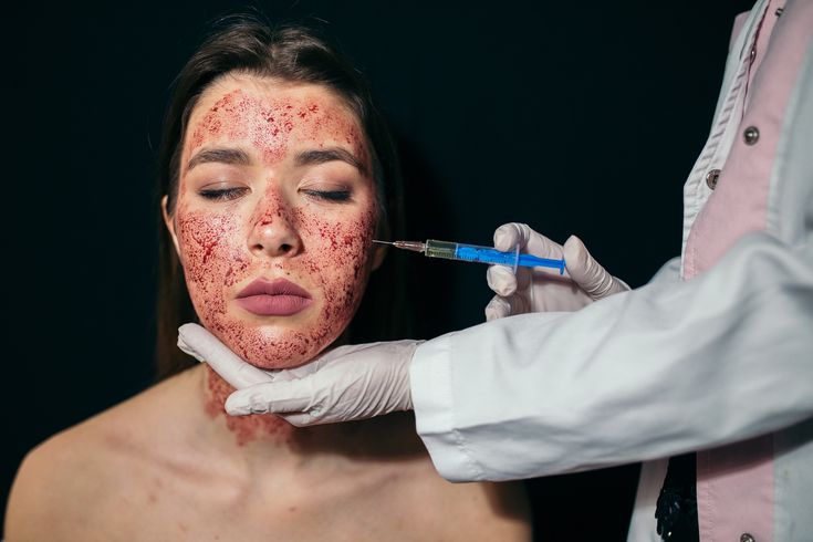 Vampire Facials: Safety, Myths, and Concerns Explained