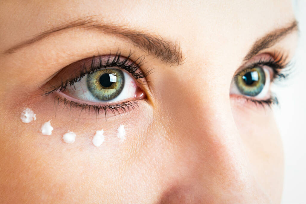 Dark Circle Treatment: Effective Solutions for Tired Eyes