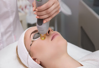 Types of Lasers in Aesthetic Medicine: A Quick Guide