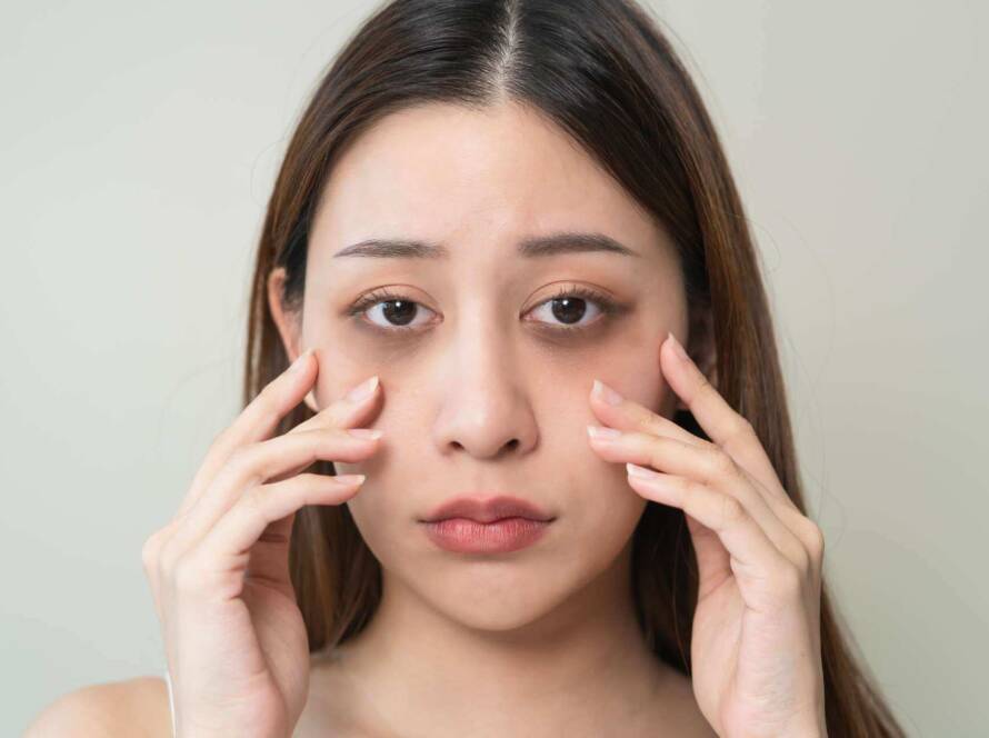 Dark circles treatments