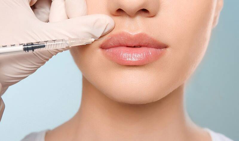 Lip Filler Treatment