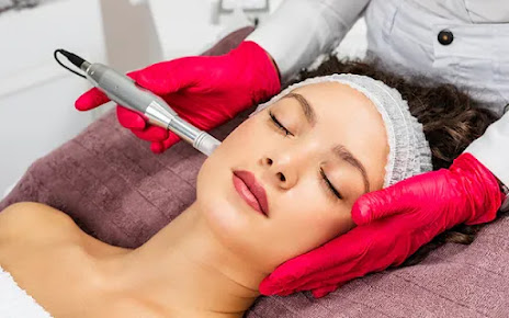 Microneedling Explained: Benefits, Procedure, Results