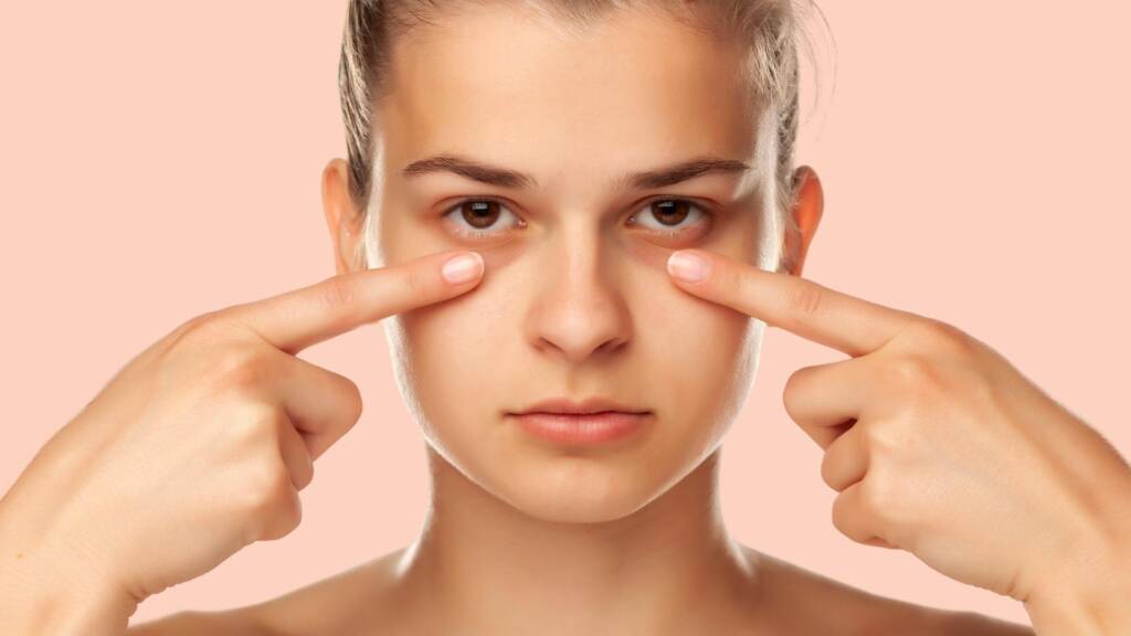 Dark Circles: Understanding Their Various Causes Clearly