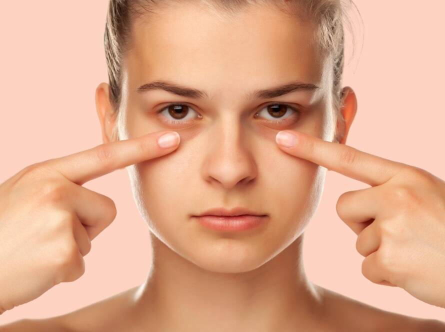 Dark circles treatments