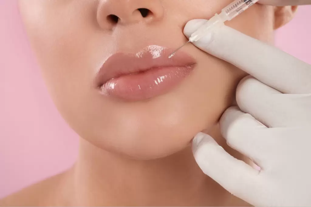 Lip Fillers : Essential Guide Before Treatment