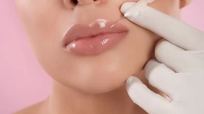 Lip Filler Treatment