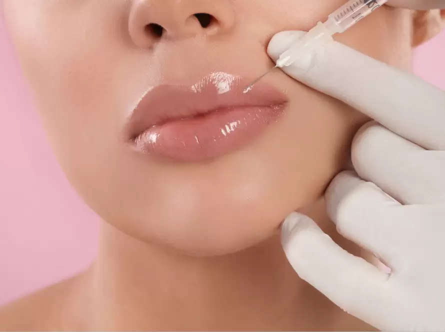 Lip Filler Treatment