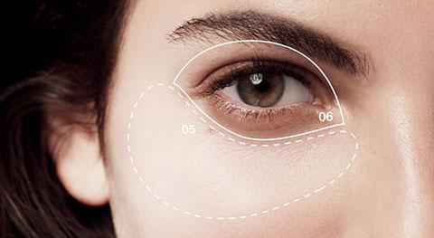 Dark Circles : How Allergies Contribute to Their Formation