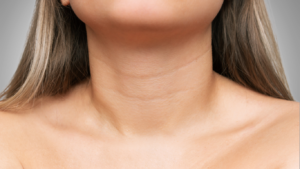Tech Neck & Wrinkles
