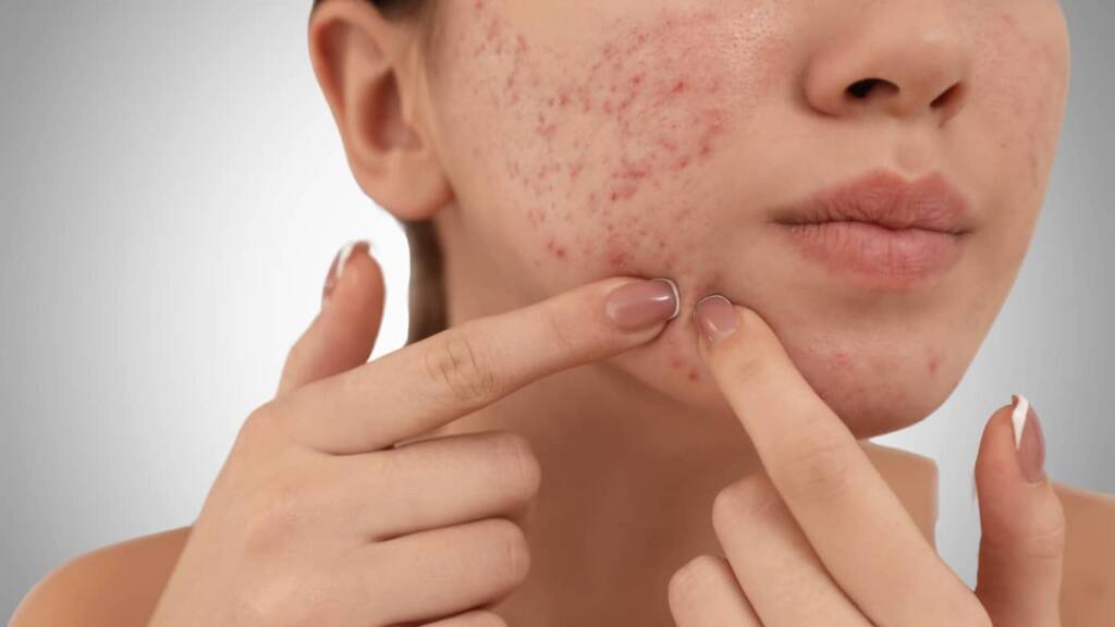 How Hormones Affect Skin at Different Life Stages