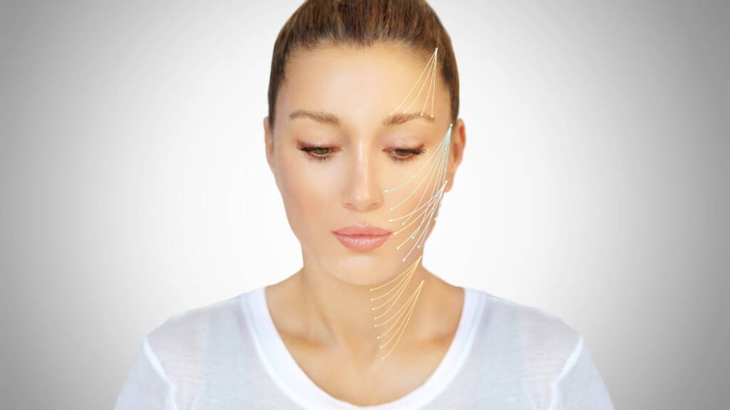 Thread Lifts: A Non-Surgical Alternative to Facelifts
