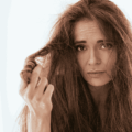 Hair Transplant vs. PRP: Which is Right for You?