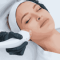 Top Non-Invasive Skin Treatments for a Youthful Glow