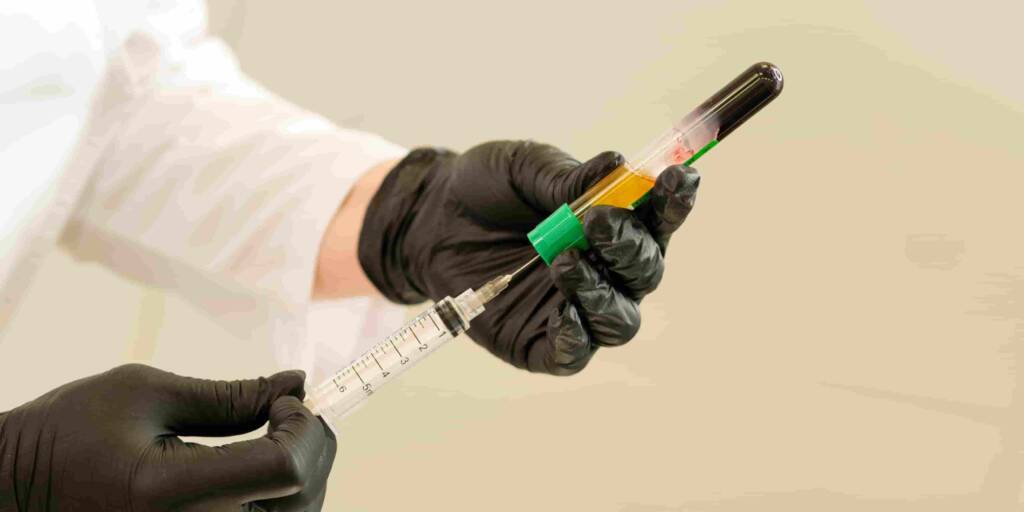PRP Beyond Hair & Skin: Surprising Benefits of Platelet-Rich Plasma